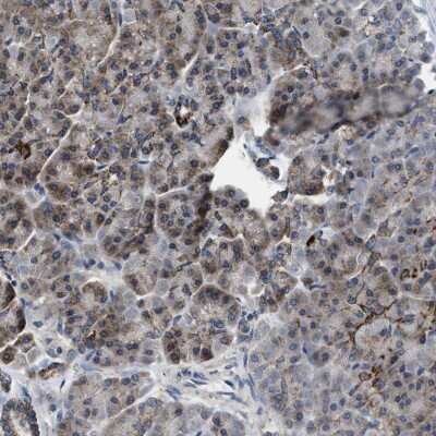 Immunohistochemistry-Paraffin: CCM2 Antibody [NBP1-86730]