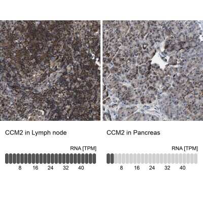 Immunohistochemistry-Paraffin: CCM2 Antibody [NBP1-86730]