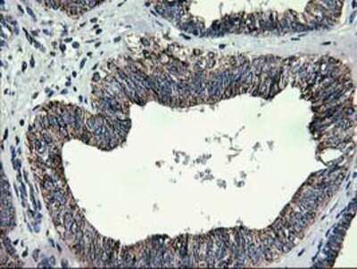 Immunohistochemistry: CCM2 Antibody (OTI1E9) - Azide and BSA Free [NBP2-72235]