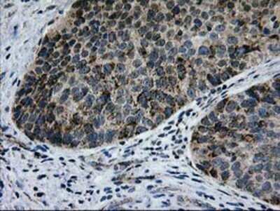 Immunohistochemistry: CCM2 Antibody (OTI1E9) - Azide and BSA Free [NBP2-72235]