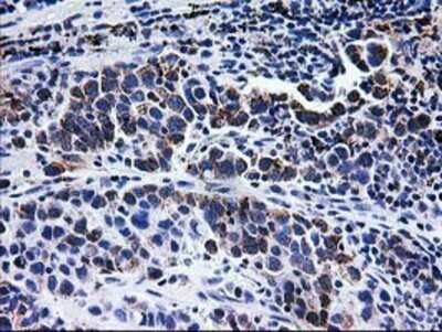Immunohistochemistry: CCM2 Antibody (OTI1E9) - Azide and BSA Free [NBP2-72235]