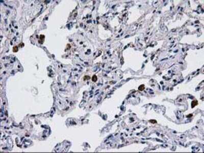 Immunohistochemistry: CCM2 Antibody (OTI1E9) - Azide and BSA Free [NBP2-72235]
