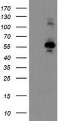 Western Blot: CCM2 Antibody (OTI1E9)Azide and BSA Free [NBP2-72235]