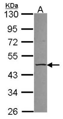 Western Blot: CCM2 Antibody [NBP2-15761]