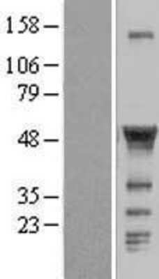 Western Blot: CCM2 Overexpression Lysate [NBL1-08862]