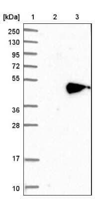 Western Blot: NOV/CCN3 Antibody [NBP1-88155]