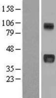 Western Blot: NOV/CCN3 Overexpression Lysate [NBL1-13729]