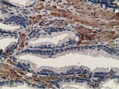 Immunohistochemistry-Paraffin: CCNB1IP1 Antibody (OTI4H3) [NBP2-00600]