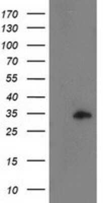 Western Blot: CCNB1IP1 Antibody (OTI4H3) [NBP2-00600]