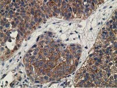 Immunohistochemistry: CCNB1IP1 Antibody (OTI4H3) - Azide and BSA Free [NBP2-72106]