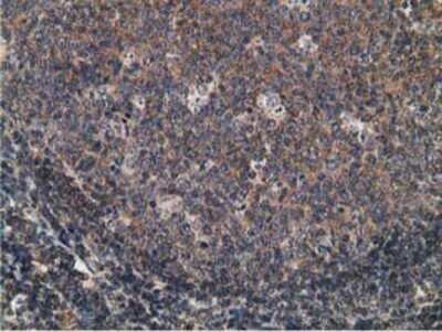 Immunohistochemistry: CCNB1IP1 Antibody (OTI4H3) - Azide and BSA Free [NBP2-72106]