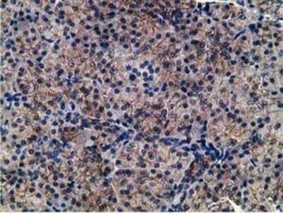 Immunohistochemistry: CCNB1IP1 Antibody (OTI4H3) - Azide and BSA Free [NBP2-72106]