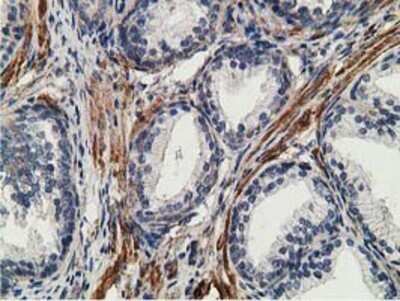 Immunohistochemistry: CCNB1IP1 Antibody (OTI4H3) - Azide and BSA Free [NBP2-72106]