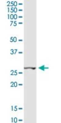 Western Blot: CCNB1IP1 Antibody [H00057820-D01P]