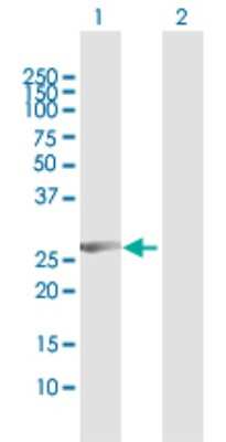 Western Blot: CCNB1IP1 Antibody [H00057820-D01P]