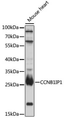 Western Blot: CCNB1IP1 AntibodyAzide and BSA Free [NBP2-92337]