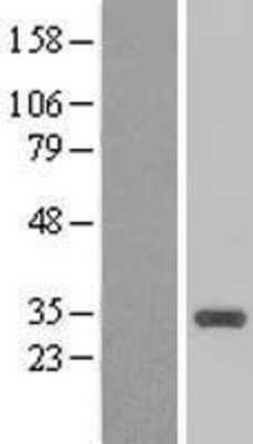 Western Blot: CCNB1IP1 Overexpression Lysate [NBL1-08867]