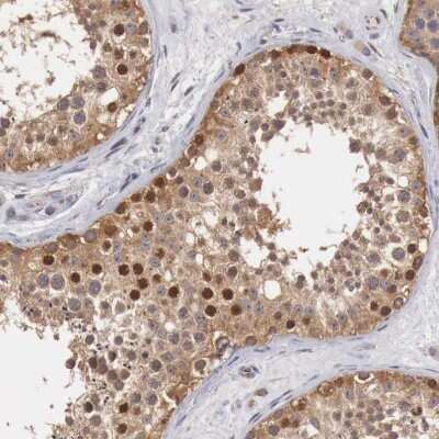 Immunohistochemistry-Paraffin: CCNB3 Antibody [NBP1-89475]