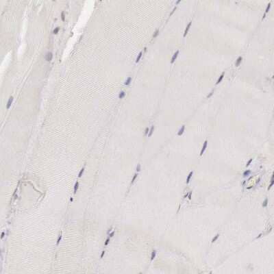 Immunohistochemistry-Paraffin: CCNB3 Antibody [NBP1-89475]