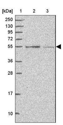 Western Blot: CCNJL Antibody [NBP2-14461]