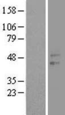 Western Blot: CCNJL Overexpression Lysate [NBL1-08886]