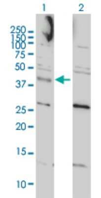 Western Blot: CCNK Antibody (3B7-1B9) [H00008812-M01]