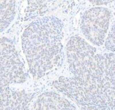 Immunohistochemistry-Paraffin: CCNK Antibody [NBP1-06519]