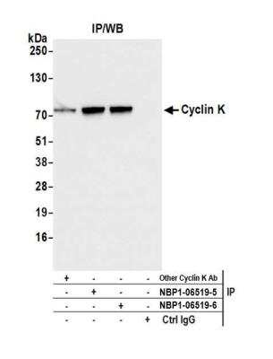 Immunoprecipitation: CCNK Antibody [NBP1-06519]