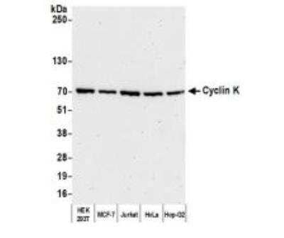 Western Blot: CCNK Antibody [NBP1-06519]