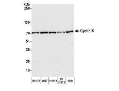 Western Blot: CCNK Antibody [NBP1-06519]