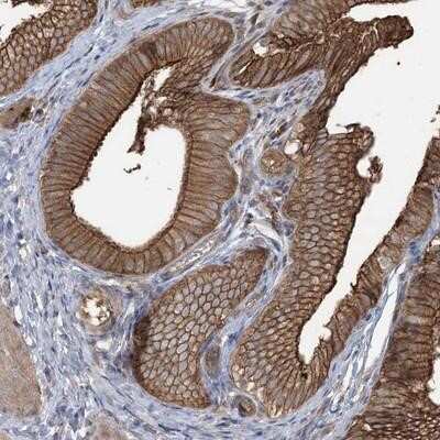 Immunohistochemistry-Paraffin: CCNY Antibody [NBP1-88542]