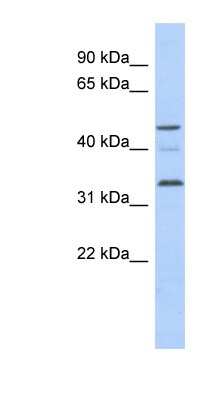 Western Blot: CCNYL1 Antibody [NBP1-70490]