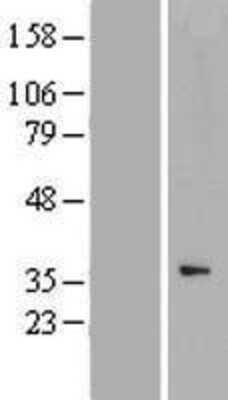 Western Blot: CCNYL1 Overexpression Lysate [NBP2-05351]