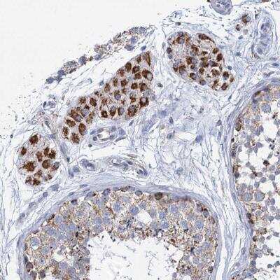 Immunohistochemistry-Paraffin: CCP110 Antibody [NBP2-13073]