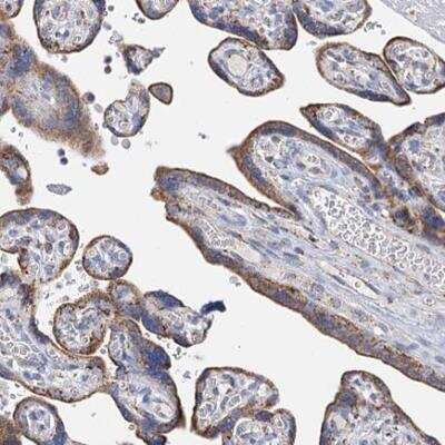 Immunohistochemistry-Paraffin: CCP110 Antibody [NBP2-13073]