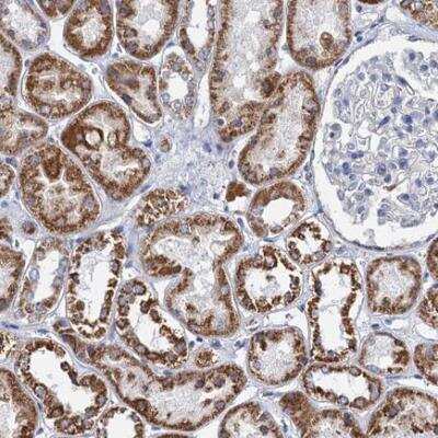 Immunohistochemistry-Paraffin: CCP110 Antibody [NBP2-13073]