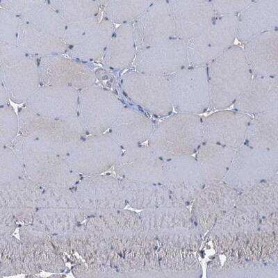Immunohistochemistry-Paraffin: CCP110 Antibody [NBP2-13073]
