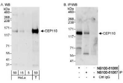 Western Blot: CCP110 Antibody [NB100-61066]