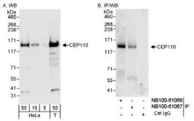 Western Blot: CCP110 Antibody [NB100-61067]