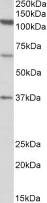 Western Blot: CCP110 Antibody [NBP2-26118]