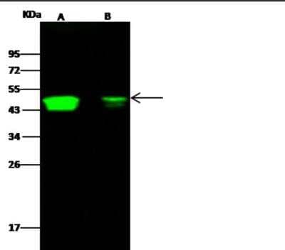 Western Blot: CCR1 Antibody (002) [NBP2-89234]