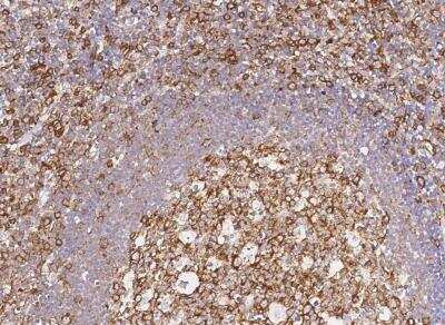 Immunohistochemistry-Paraffin: CCR1 Antibody (003) [NBP2-89235]