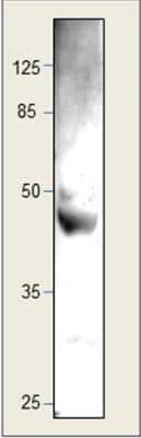 Western Blot: CCR1 Antibody [NBP1-78173]