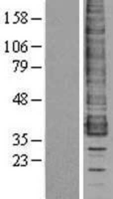 Western Blot: CCR1 Overexpression Lysate [NBL1-08887]