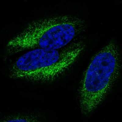 Immunocytochemistry/ Immunofluorescence: CCR10/GPR2 Antibody [NBP2-56272]