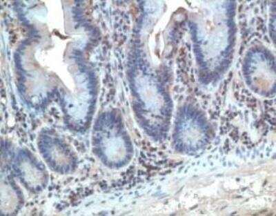 Immunohistochemistry: CCR10/GPR2 Antibody [NB100-707]