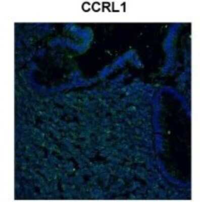 Immunohistochemistry-Paraffin: CCR11 Antibody [NBP1-79925]