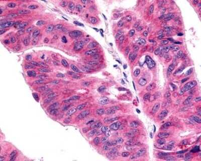 Immunohistochemistry-Paraffin: CCR11 Antibody - BSA Free [NLS1441]