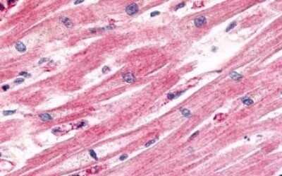 Immunohistochemistry-Paraffin: CCR11 Antibody - BSA Free [NLS1441]