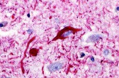 Immunohistochemistry-Paraffin: CCR11 Antibody - BSA Free [NLS1441]